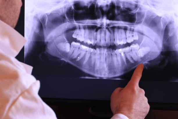 Best Broken or Cracked Tooth Emergency Dentist in Manorville, NY