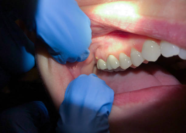 Best Pediatric Emergency Dentist in Manorville, NY